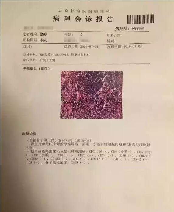 【经纬】90 后演员去世:淋巴瘤这些知识你不可不知